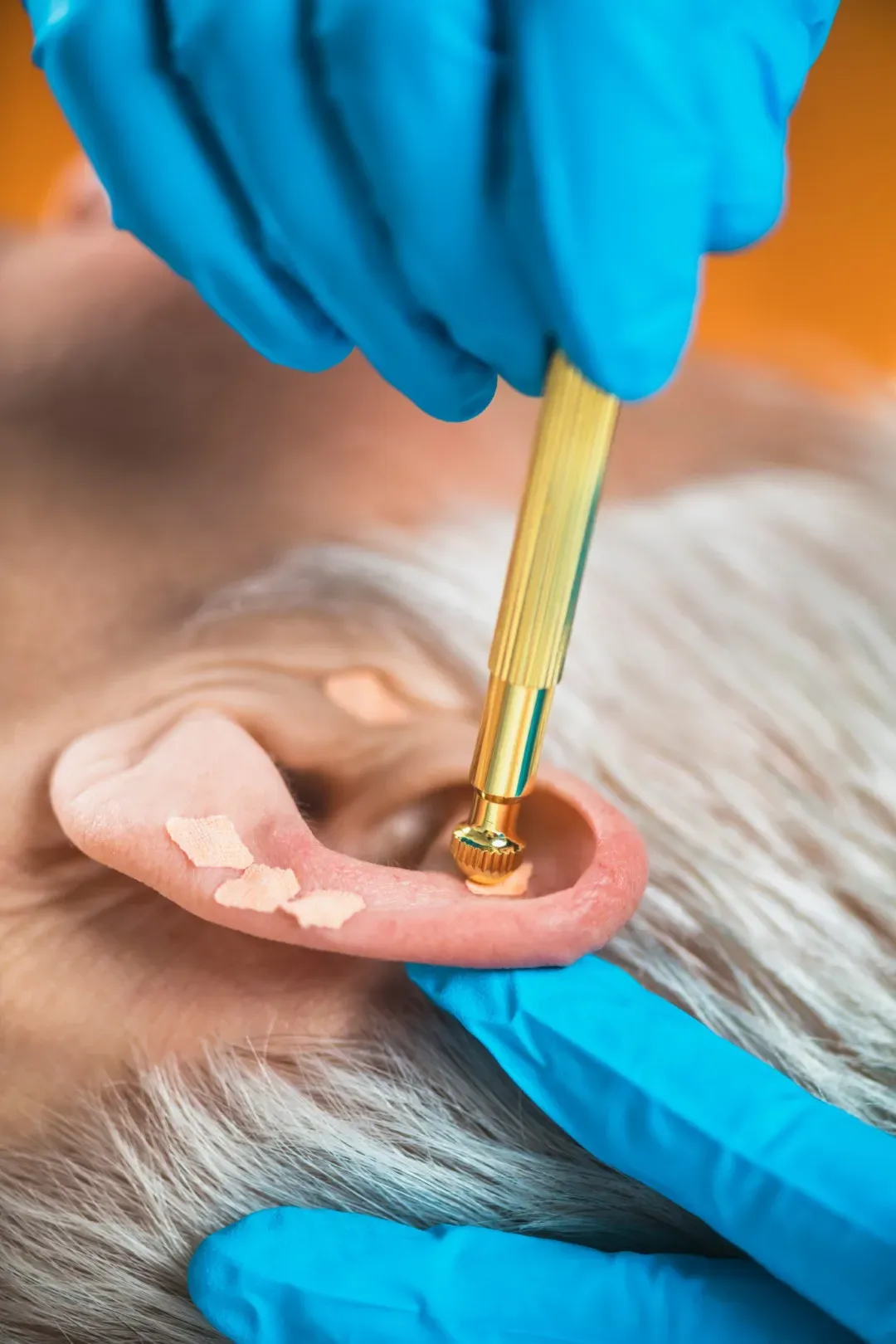 auriculotherapie (3)